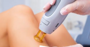 Laser Hair Removal | Non-Surgical Cosmetic Procedures | SkinDC