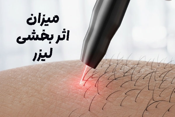 تاثیر بخشی لیزر