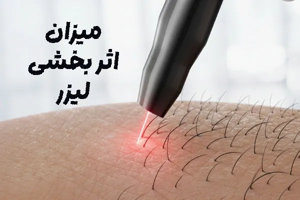 تاثیر بخشی لیزر