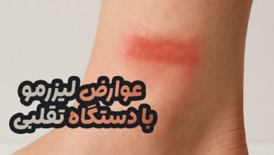 عوارض لیزرمو با دستگاه تقلبی