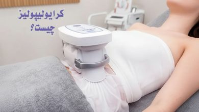 کرایو لیپولیز