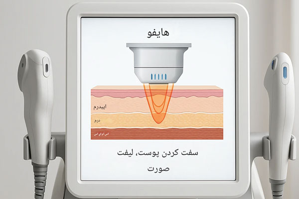 هاای