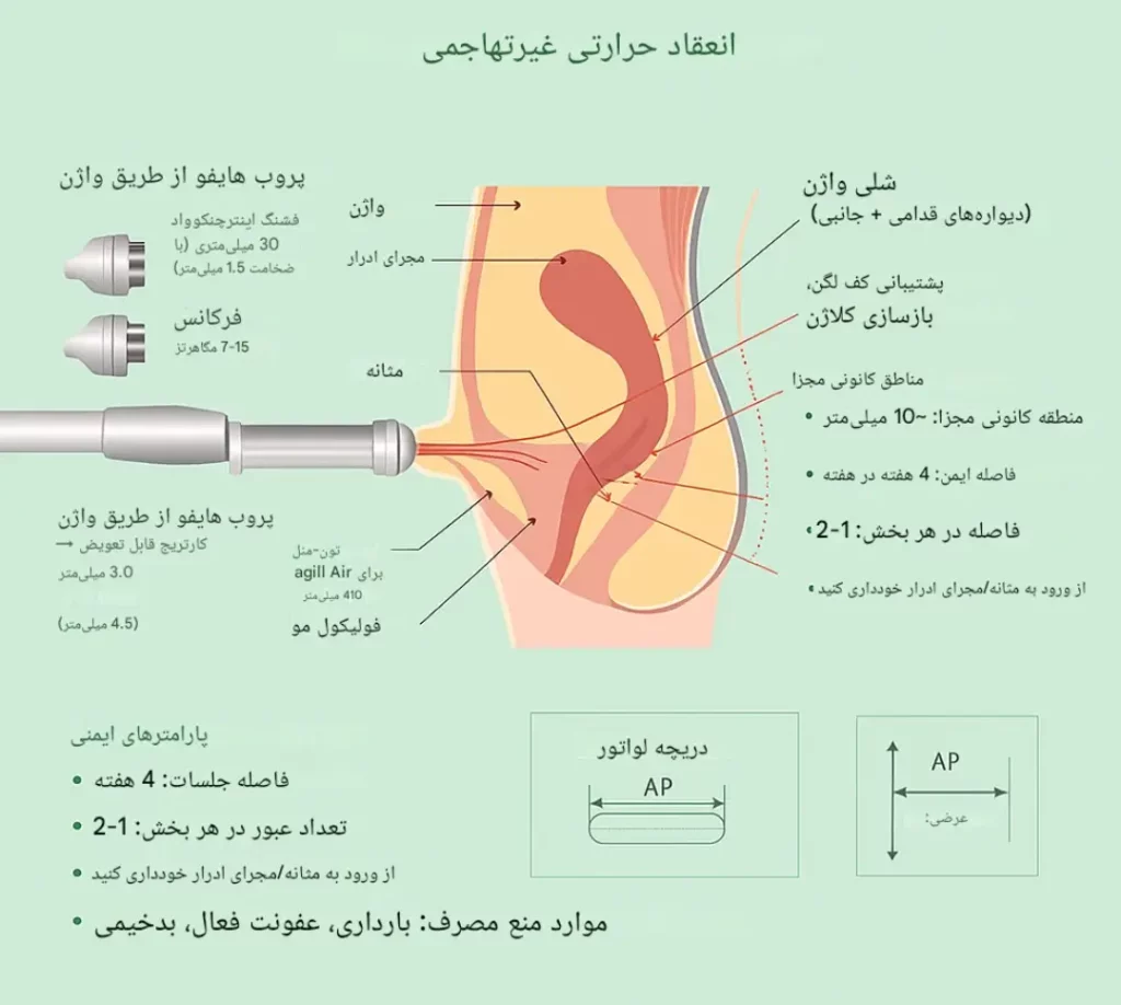 کاربرد هایفو واژینال
