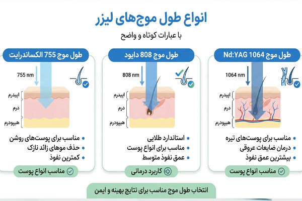 این انواع طول موج های لیزر