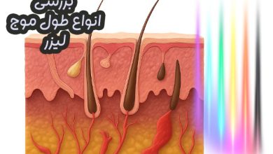 اتواع طول موج های لیزر