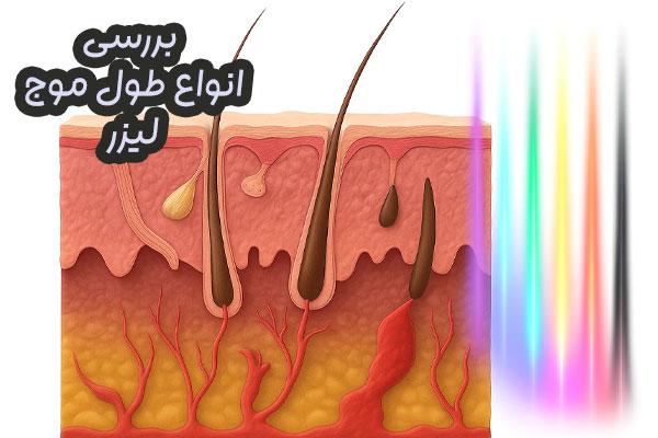 اتواع طول موج های لیزر
