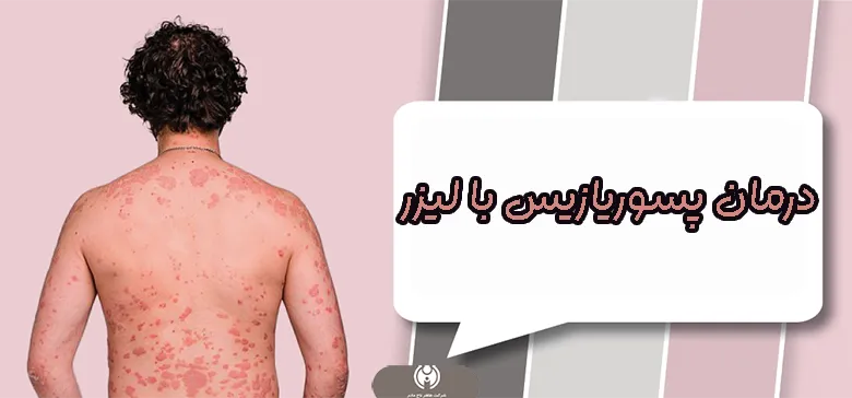 درمان پسوریازیس با لیزر