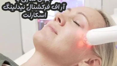 آر اف فرکشنال نیدلینگ اسکارلت