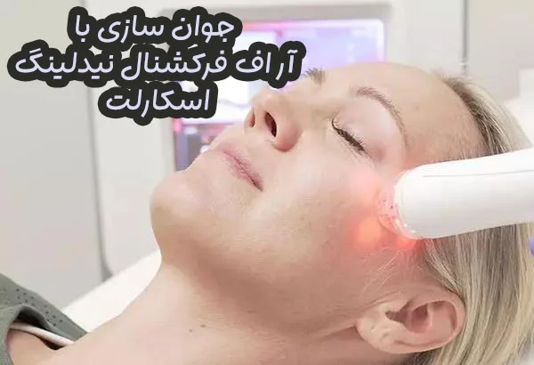 آر اف فرکشنال نیدلینگ اسکارلت