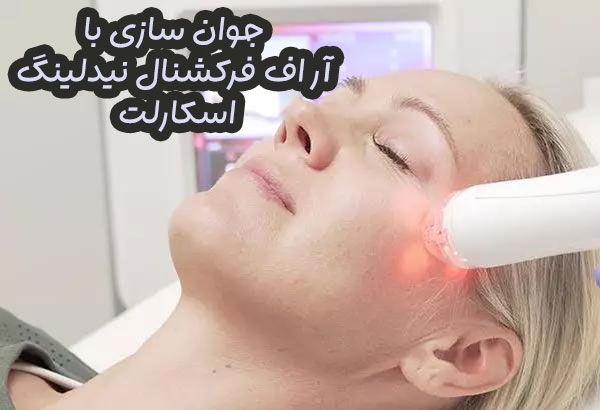 آر اف فرکشنال نیدلینگ اسکارلت