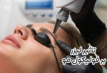 تاثیر لیزر بر فولیکول مو