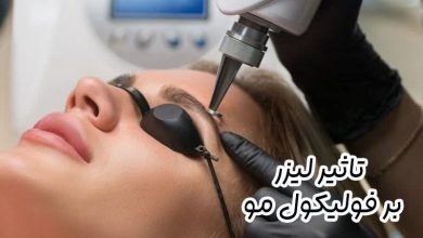 تاثیر لیزر بر فولیکول مو