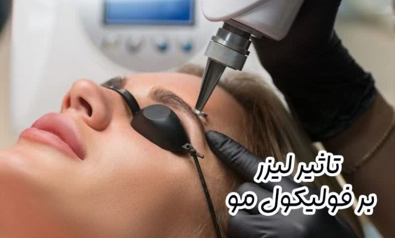 تاثیر لیزر بر فولیکول مو