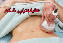 هایفوتراپی شکم