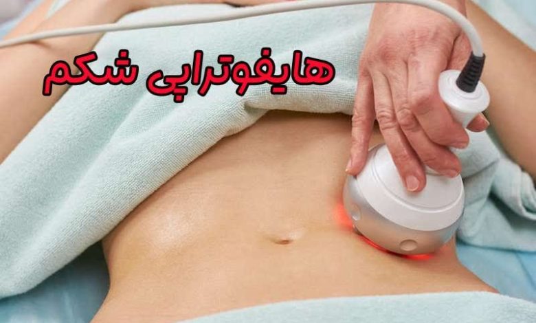 هایفوتراپی شکم