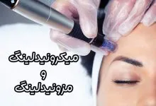 میکرونیدلینگ و مزونیدلینگ