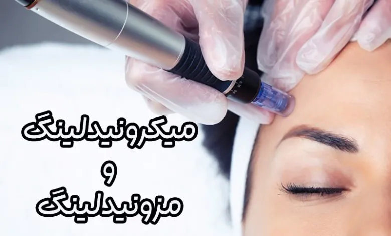 میکرونیدلینگ و مزونیدلینگ