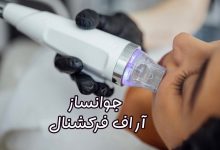 دستگاه آر اف فرکشنال