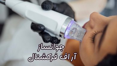 دستگاه آر اف فرکشنال