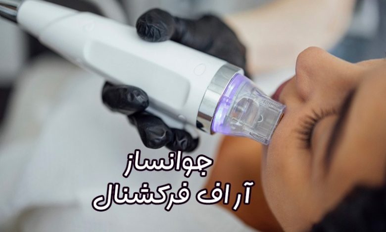 دستگاه آر اف فرکشنال